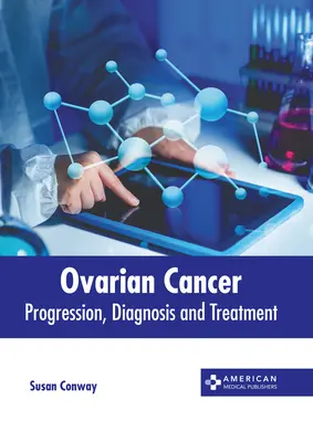 Rakovina vaječníkov: Variácie: liečba, diagnostika a liečba - Ovarian Cancer: Progression, Diagnosis and Treatment