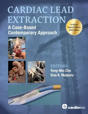 Extrakcia srdcového olova: Súčasný prístup založený na konkrétnych prípadoch - Cardiac Lead Extraction: A Case-Based Contemporary Approach