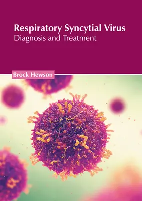 Respiračný syncyciálny vírus: Diagnóza a liečba - Respiratory Syncytial Virus: Diagnosis and Treatment