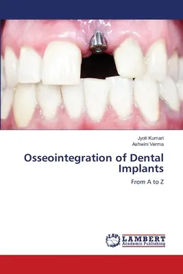 Oseointegrácia zubných implantátov - Osseointegration of Dental Implants