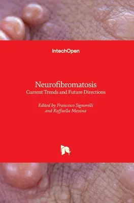 Neurofibromatóza: Súčasné trendy a budúce smery - Neurofibromatosis: Current Trends and Future Directions