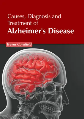 Príčiny, diagnostika a liečba Alzheimerovej choroby - Causes, Diagnosis and Treatment of Alzheimer's Disease
