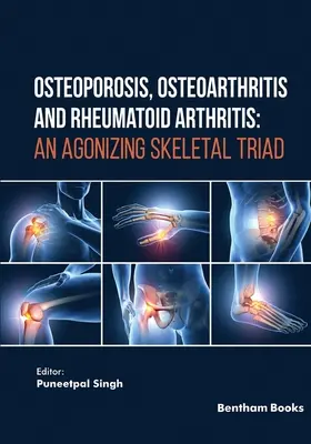 Osteoporóza, osteoartritída a reumatoidná artritída: Skeletálna triáda, ktorá spôsobuje utrpenie - Osteoporosis, Osteoarthritis and Rheumatoid Arthritis: An Agonizing Skeletal Triad