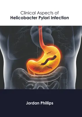 Klinické aspekty infekcie Helicobacter Pylori - Clinical Aspects of Helicobacter Pylori Infection