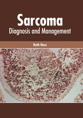 Sarcoma: Diagnostika a manažment - Sarcoma: Diagnosis and Management