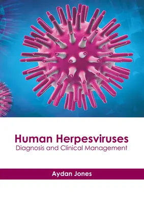 Ľudské herpesvírusy: Diagnostika a klinický manažment - Human Herpesviruses: Diagnosis and Clinical Management