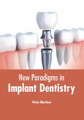 Nové paradigmy v implantológii - New Paradigms in Implant Dentistry