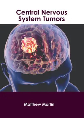 Nádory centrálneho nervového systému - Central Nervous System Tumors