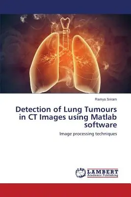 Detekcia pľúcnych nádorov na CT snímkach pomocou softvéru Matlab - Detection of Lung Tumours in CT Images using Matlab software