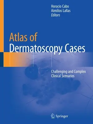 Atlas dermatoskopických prípadov: Náročné a komplexné klinické scenáre - Atlas of Dermatoscopy Cases: Challenging and Complex Clinical Scenarios