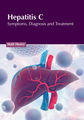Hepatitída C: Príznaky, diagnostika a liečba - Hepatitis C: Symptoms, Diagnosis and Treatment