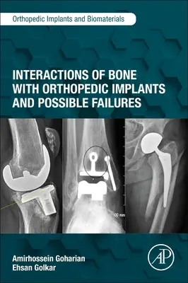 Interakcie kostí s ortopedickými implantátmi a možné poruchy - Interactions of Bone with Orthopedic Implants and Possible Failures