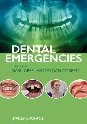 Zubné pohotovosti - Dental Emergencies
