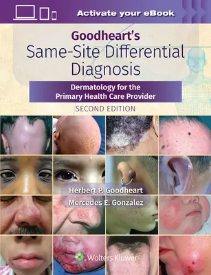 Goodheartova diferenciálna diagnostika na rovnakom mieste: Dermatológia pre poskytovateľov primárnej zdravotnej starostlivosti - Goodheart's Same-Site Differential Diagnosis: Dermatology for the Primary Health Care Provider