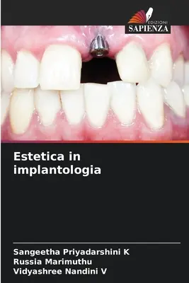 Estetika v implantológii - Estetica in implantologia