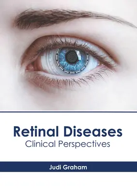 Choroby sietnice: Klinické perspektívy - Retinal Diseases: Clinical Perspectives