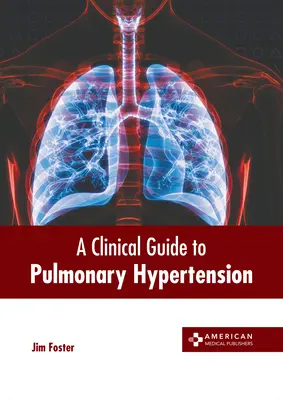 Klinický sprievodca pľúcnou hypertenziou - A Clinical Guide to Pulmonary Hypertension