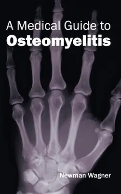 Lekársky sprievodca osteomyelitídou - Medical Guide to Osteomyelitis