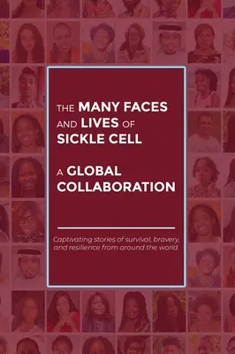 Mnoho tvárí a životov pacientov s kosáčikovitými bunkami - globálna spolupráca - The Many Faces and Lives of Sickle Cell - A Global Collaboration