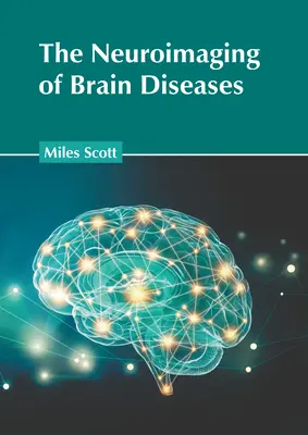Neurozobrazovanie ochorení mozgu - The Neuroimaging of Brain Diseases