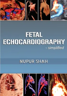 Fetálna echokardiografia - zjednodušene - Fetal Echocardiography - Simplified