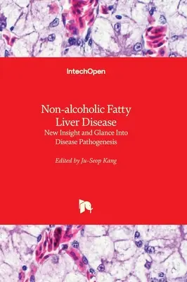 Nealkoholická tuková choroba pečene - nové poznatky a pohľad na patogenézu ochorenia - Non-alcoholic Fatty Liver Disease - New Insight and Glance Into Disease Pathogenesis