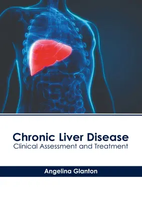 Chronické ochorenie pečene: Klinické hodnotenie a liečba - Chronic Liver Disease: Clinical Assessment and Treatment