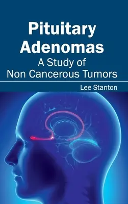 Adenómy hypofýzy: A Study of Non Cancerous Tumors (Štúdia nenádorových nádorov) - Pituitary Adenomas: A Study of Non Cancerous Tumors