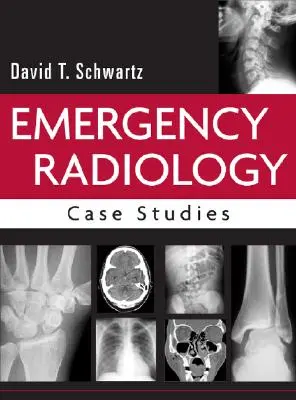 Pohotovostná rádiológia: Prípadové štúdie - Emergency Radiology: Case Studies
