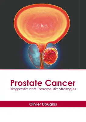 Rakovina prostaty: Diagnostické a terapeutické stratégie - Prostate Cancer: Diagnostic and Therapeutic Strategies