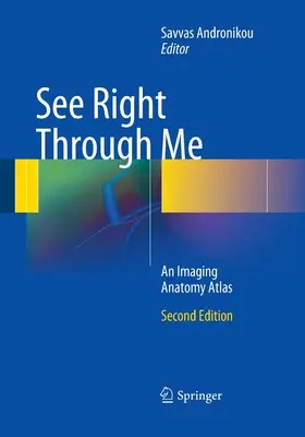 Vidieť priamo cezo mňa: Anatomický atlas zobrazovania - See Right Through Me: An Imaging Anatomy Atlas