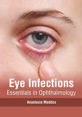 Očné infekcie: Základy oftalmológie - Eye Infections: Essentials in Ophthalmology