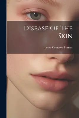 Kožné ochorenia - Disease Of The Skin