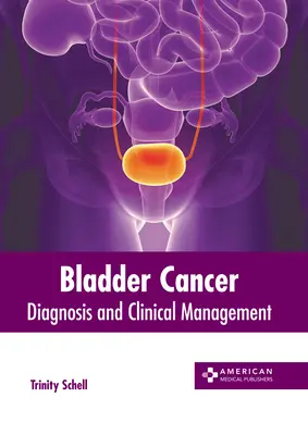 Rakovina močového mechúra: Močový mechúr: diagnostika a klinický manažment - Bladder Cancer: Diagnosis and Clinical Management