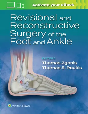 Revízne a rekonštrukčné operácie nohy a členka - Revisional and Reconstructive Surgery of the Foot and Ankle