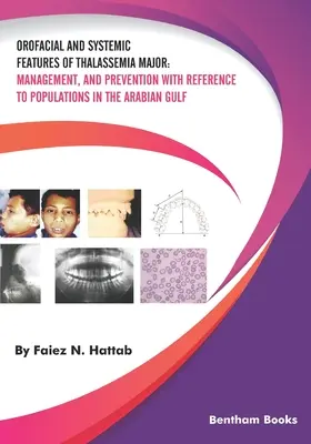 Orofaciálne a systémové znaky talasémie major: a prevencia s ohľadom na populáciu v Arabskom zálive - Orofacial and Systemic Features of Thalassemia Major: Management, and Prevention with Reference to Populations in the Arabian Gulf