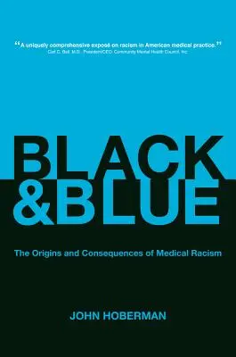 Čierna a modrá: Pôvod a dôsledky lekárskeho rasizmu - Black and Blue: The Origins and Consequences of Medical Racism