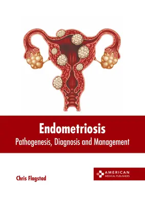 Endometrióza: Patogenéza, diagnostika a liečba - Endometriosis: Pathogenesis, Diagnosis and Management