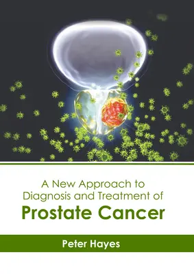 Nový prístup k diagnostike a liečbe rakoviny prostaty - A New Approach to Diagnosis and Treatment of Prostate Cancer