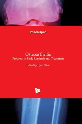 Osteoartróza: Pokrok v základnom výskume a liečbe - Osteoarthritis: Progress in Basic Research and Treatment