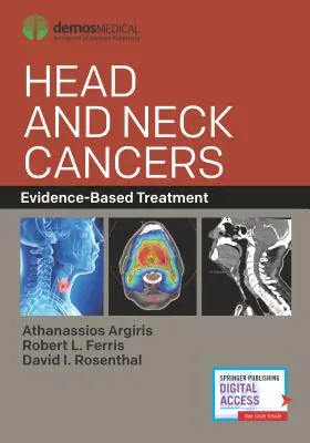 Rakovina hlavy a krku: Liečba založená na dôkazoch - Head and Neck Cancers: Evidence-Based Treatment