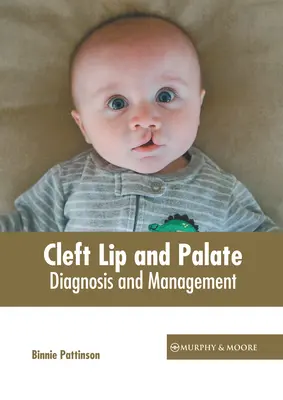 Rozštep pery a podnebia: Vymenujte si ich: Diagnostika a liečba - Cleft Lip and Palate: Diagnosis and Management