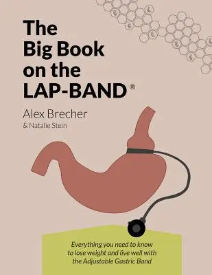 The Big Book on the Lap-Band: Everything You Need to Know to Lose Weight and Live Well with Adjustable Gastric Band (Veľká kniha o Lap-Bande: Všetko, čo potrebujete vedieť, aby ste schudli a žili dobre s nastaviteľnou žalúdočnou bandážou) - The Big Book on the Lap-Band: Everything You Need to Know to Lose Weight and Live Well with the Adjustable Gastric Band