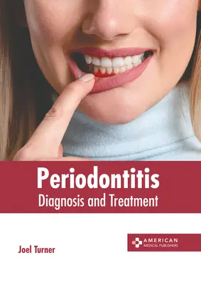 Periodontitis: Diagnostika a liečba - Periodontitis: Diagnosis and Treatment