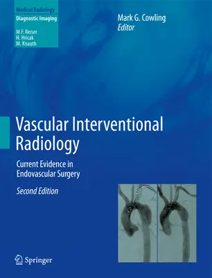 Vaskulárna intervenčná rádiológia: Súčasné poznatky v endovaskulárnej chirurgii - Vascular Interventional Radiology: Current Evidence in Endovascular Surgery