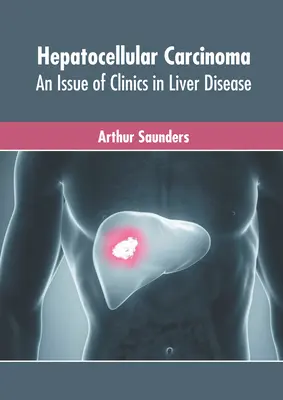 Hepatocelulárny karcinóm: vydanie Kliniky ochorení pečene - Hepatocellular Carcinoma: An Issue of Clinics in Liver Disease