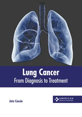 Rakovina pľúc: Od diagnózy k liečbe - Lung Cancer: From Diagnosis to Treatment