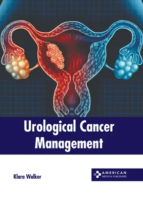 Manažment urologickej rakoviny - Urological Cancer Management