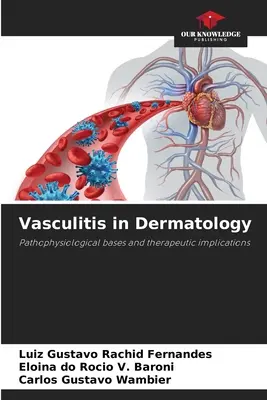 Vaskulitída v dermatológii - Vasculitis in Dermatology