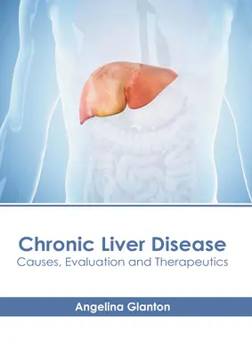 Chronické ochorenie pečene: Príčiny, hodnotenie a terapia - Chronic Liver Disease: Causes, Evaluation and Therapeutics